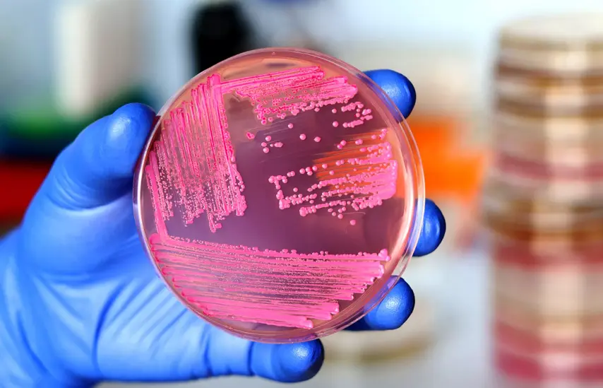 Hand of a researcher showing a close-up of a microbiological culture plate with yeast
